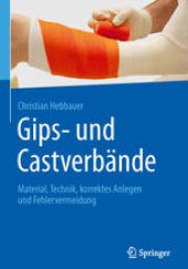 book Gips- und Castverbände: Material, Technik, korrektes Anlegen und Fehlervermeidung