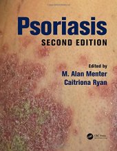 book Psoriasis, Second Edition