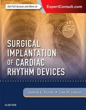 book Surgical Implantation of Cardiac Rhythm Devices