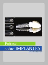 book Manual de protese sobre implantes - Passos Clinicos e Laboratoriais