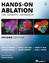 book Hands-On Ablation: The Experts’ Approach