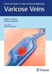 book Varicose Veins