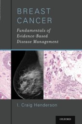 book Breast Cancer Fundamentals of Evidence-Based Disease Management