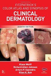 book Fitzpatrick’s Color Atlas and Synopsis of Clinical Dermatology