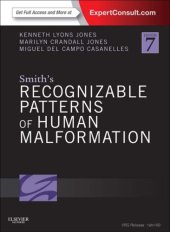 book Smith’s Recognizable Patterns of Human Malformation