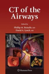 book CT of the Airways