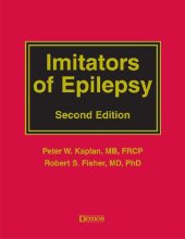 book Imitators of Epilepsy