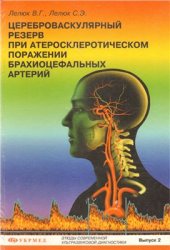 book Цереброваскулярный резерв при атеросклеротическом поражении брахиоцефальных артерий