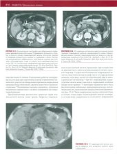 book Травма. Том 2. Часть 2