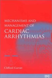 book Mechanisms and Management of Cardiac Arrhythmias
