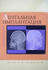 book Дентальная имплантация. Критерии успеха