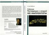 book Съемные реставрации с опорой на имплантаты