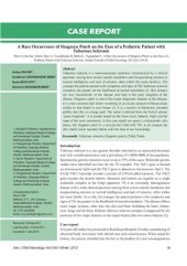 book Rare occurrence of shagreen patch on the face of a pediatric patient with tuberous sclerosis