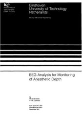 book EEG analysis of monitoring of anaestetics depth