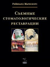 book Съемные стоматологические реставрации