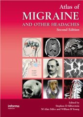 book Atlas of Migraine and Other Headaches