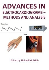 book Advances in Electrocardiograms: Methods and Analysis