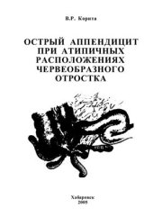 book Острый аппендицит при атипичных расположениях червеобразного отростка