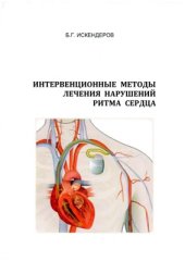 book Интервенционные методы лечения нарушений ритма сердца