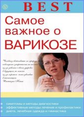 book Самое важное о варикозе