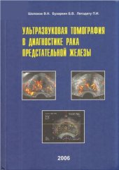 book Ультразвуковая томография в диагностике рака предстательной железы