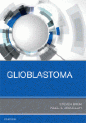 book Glioblastoma