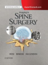 book Imaging in Spine Surgery