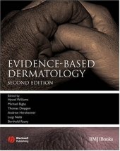 book Evidence-Based Dermatology