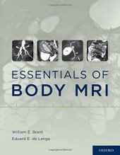 book Essentials of body MRI