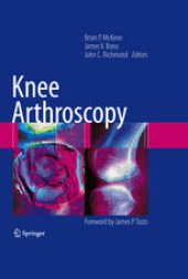 book Knee Arthroscopy