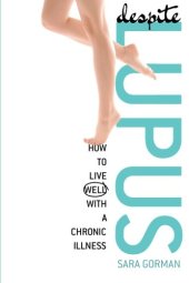 book Despite lupus : how to live well with a chronic illness