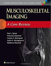 book Musculoskeletal imaging a core review : [includes interactive ebook with complete content]