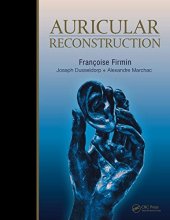 book Auricular Reconstruction