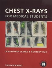 book Chest X-rays for Medical Students