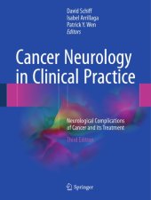 book Cancer neurology in clinical practice : neurological complications of cancer and its treatment