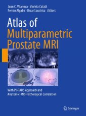 book Atlas of multiparametric prostate MRI : with PI-RADS approach and anatomic-MRI-pathological correlation