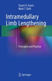 book Intramedullary limb lengthening : principles and practice