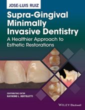 book Supra-Gingival Minimally Invasive Dentistry: A Healthier Approach to Esthetic Restorations