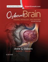 book Osborn’s Brain: imaging, pathology, and anatomy