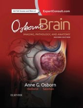 book Osborn’s brain : imaging, pathology, and anatomy