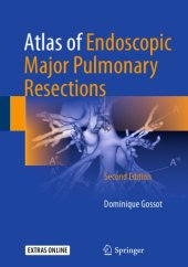 book Atlas of Endoscopic Major Pulmonary Resections