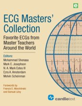 book ECG Masters Collection. Favorite ECGs From Master Teachers Around The World