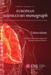 book Tuberculosis