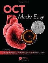 book OCT Made Easy