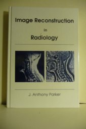 book Image Reconstruction in Radiology