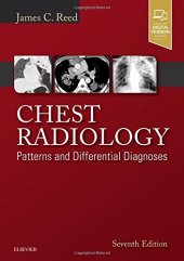 book Chest Radiology: Patterns and Differential Diagnoses, 7e