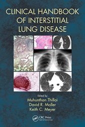 book Clinical Handbook of Interstitial Lung Disease