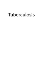 book Tuberculosis : The Essentials, Fourth Edition