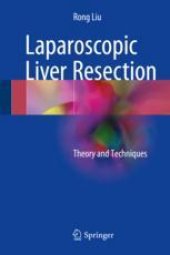 book  Laparoscopic Liver Resection: Theory and Techniques