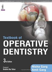 book Textbook of Operative Dentistry